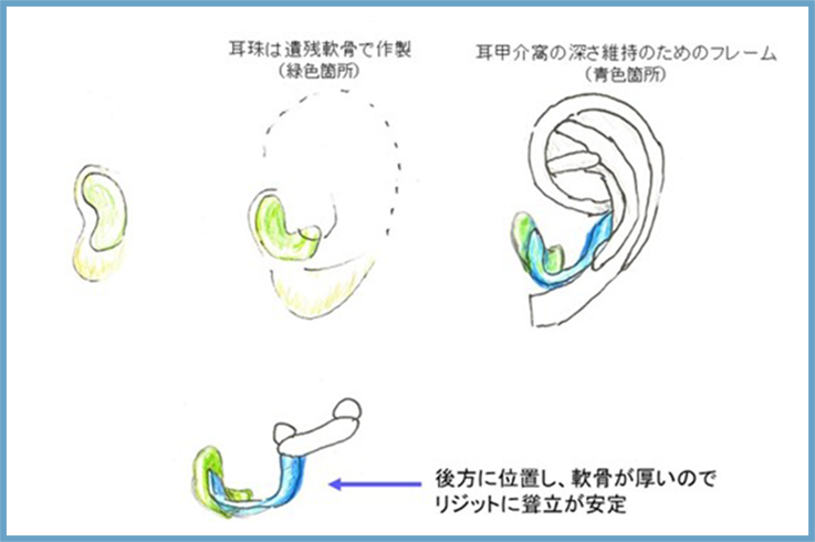 名古屋市で小耳症の治療はゆり形成栄久屋大通クリニックへ