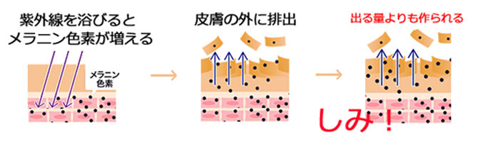 名古屋市でしみの治療はゆり形成栄久屋大通クリニック 名古屋のゆり形成栄久屋大通クリニック あざの治療なら当院へ